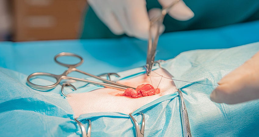 transplantation